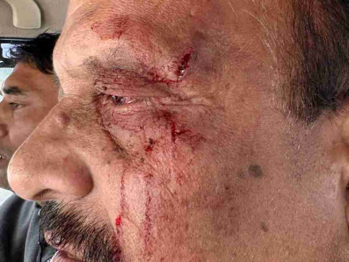 प्रारंभिक शिक्षा निदेशक से मारपीट, बीजेपी विधायक उमेश शर्मा काऊ के समर्थकों पर लगा आरोप,  सियासत गरमाई