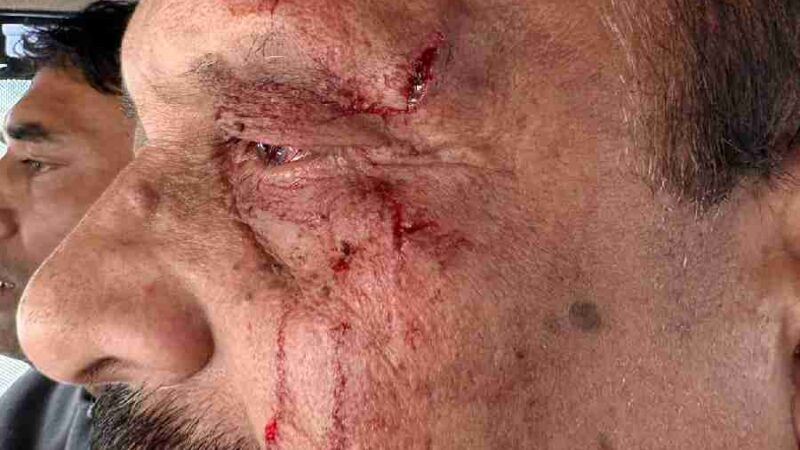 प्रारंभिक शिक्षा निदेशक से मारपीट, बीजेपी विधायक उमेश शर्मा काऊ के समर्थकों पर लगा आरोप,  सियासत गरमाई