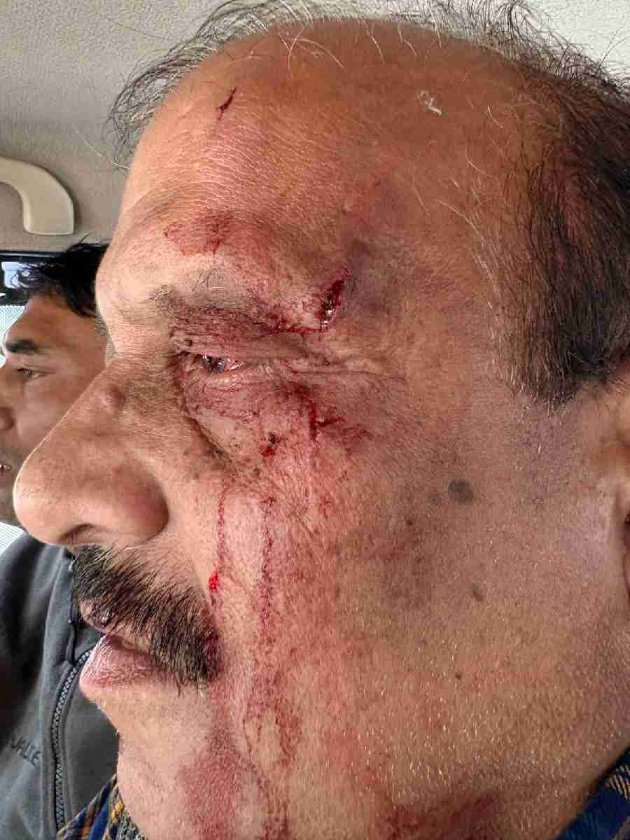 प्रारंभिक शिक्षा निदेशक से मारपीट, बीजेपी विधायक उमेश शर्मा काऊ के समर्थकों पर लगा आरोप,  सियासत गरमाई